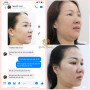 KHÁCH HÀNG NỌNG CẰM